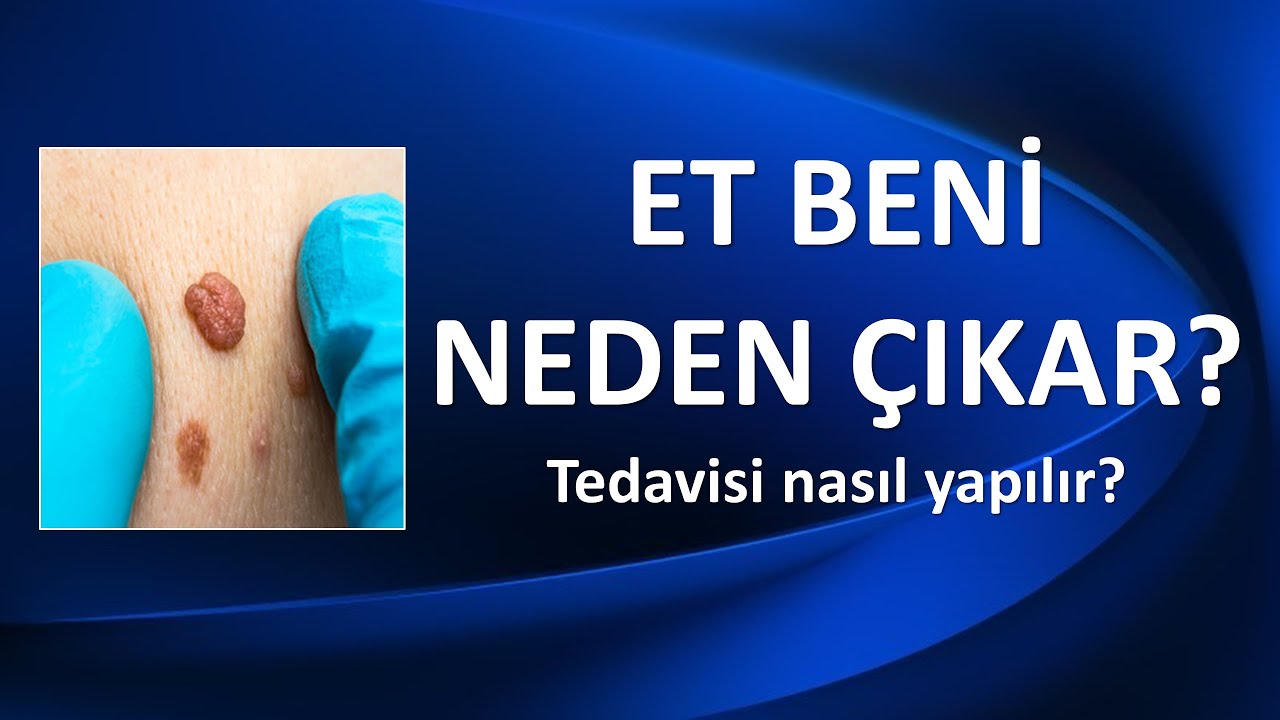 Et Beni Neden Çıkar? Doğal Tedavi Yöntemleri 2024